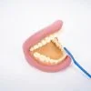 Giant Teeth Demonstration Model